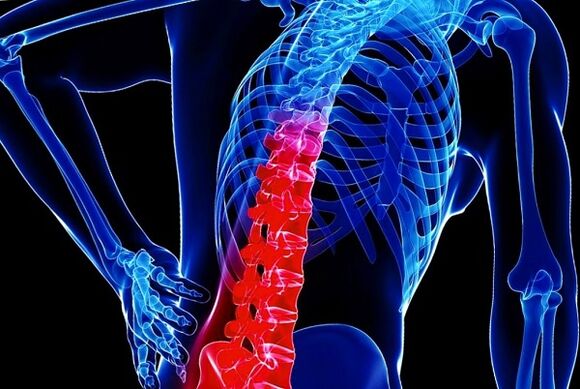 D'Grënn fir d'Entwécklung vun thoracic Osteochonds
